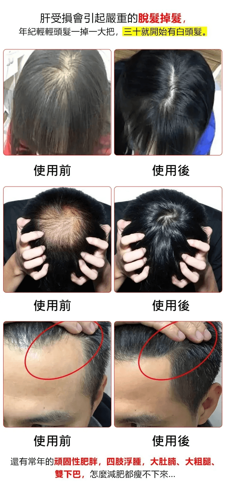 妙萊康葛根靈芝片